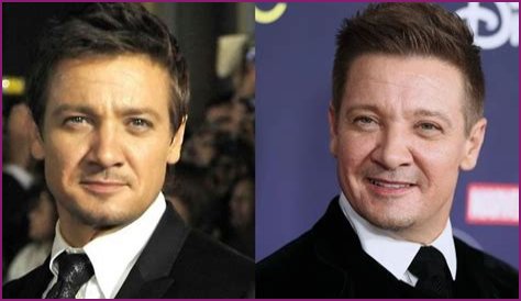 Jeremy Renner Plastic Surgery Before and After