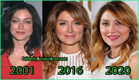 Sasha Alexander Plastic Surgery Before and After