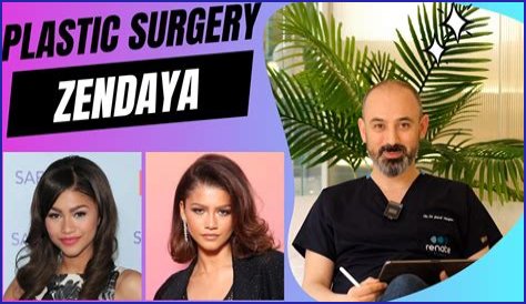 Unveiling The Truth: Zendaya's Plastic Surgery Journey